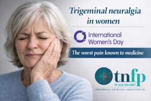 Trigeminal neuralgia in women
